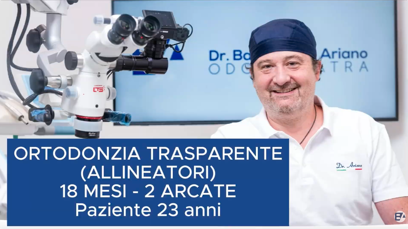 23 anni - Allineatori - 18 mesi